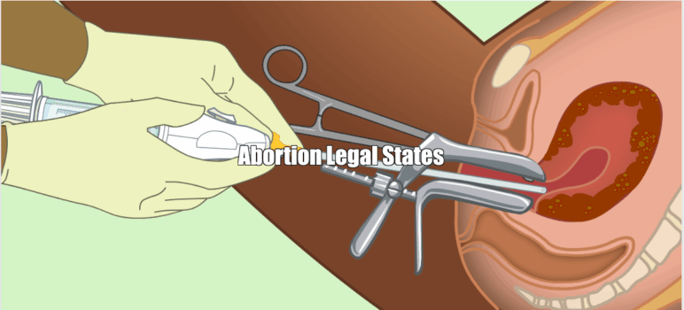 Abortion Legal States in the USA in 2025